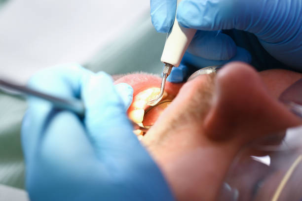 Best Orthodontic Emergency Dentist in La Plata, MD