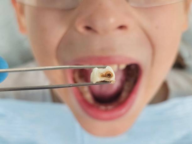 Best Weekend Emergency Dentist in La Plata, MD